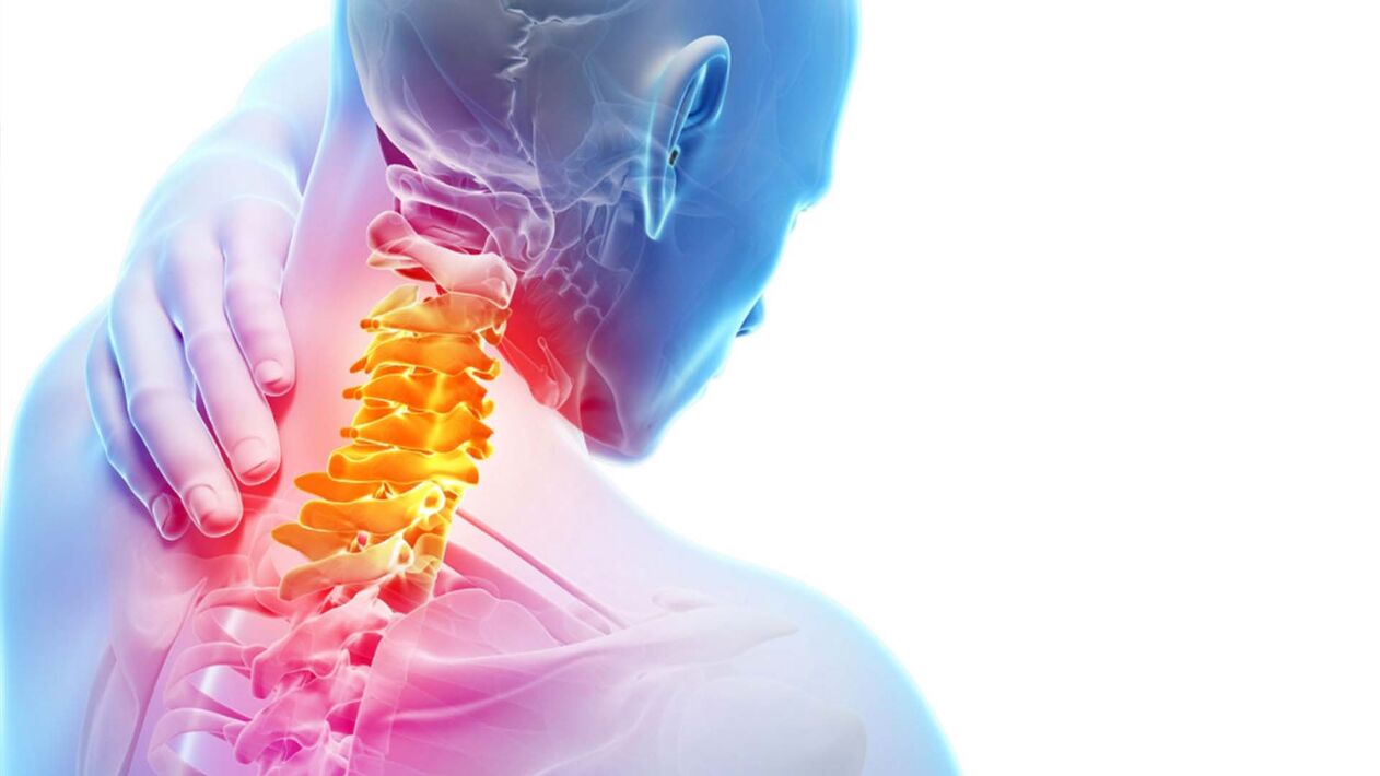 A nyaki gerinc osteochondrosis: kezelés, tünetek - Hondrostrong